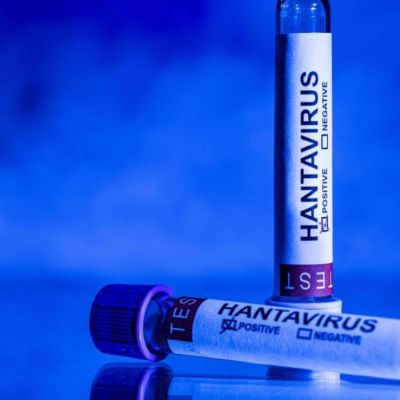 Nuevo-positivo-de-hantavirus-en-Espana-pasajero-evacuado-del-crucero-Hondius-ingresado-en-el-Gomez-Ulla