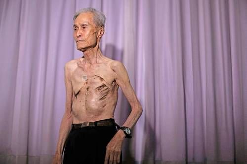 Alcalde-de-Nagasaki-califica-las-armas-nucleares-como-un-mal-absoluto-en-el-81-aniversario-del-bombardeo