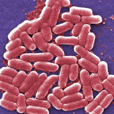 Alertan-en-EU-por-brote-de-E.-coli-ligado-a-frutos-rojos-congelados-GreenWise