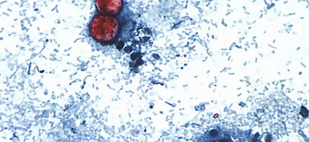 Cofepris-no-detecta-Cyclospora-en-muestras-de-16-hoteles-de-la-Riviera-Maya