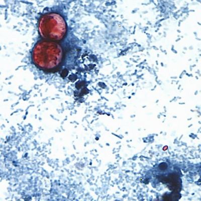 EU-reporta-dos-muertes-por-ciclosporiasis-en-Michigan-durante-brote-intestinal