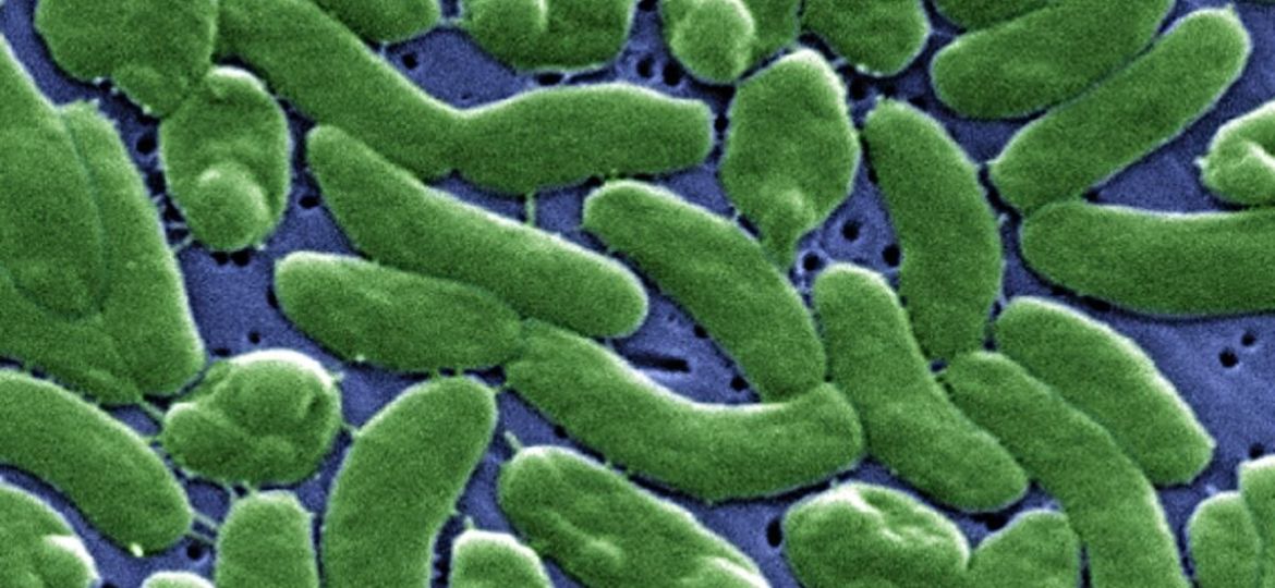 Louisiana-alerta-por-nueve-casos-de-Vibrio-vulnificus-y-cinco-muertes