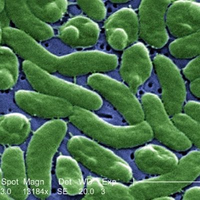 Louisiana-alerta-por-nueve-casos-de-Vibrio-vulnificus-y-cinco-muertes