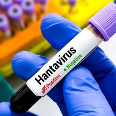 Turista-da-positivo-a-hantavirus-Andes-tras-viajar-por-Francia-y-permanece-aislado-en-Espana
